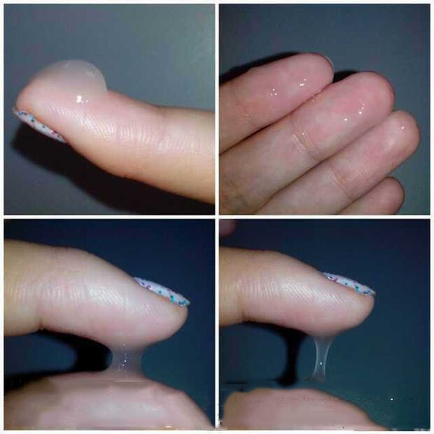 What does it look like